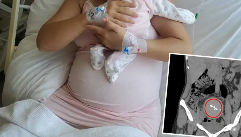 Unutulan Bebek İki Yıl Sonra Ortaya Çıktı: Sağlıkta İhmal Alarmı!