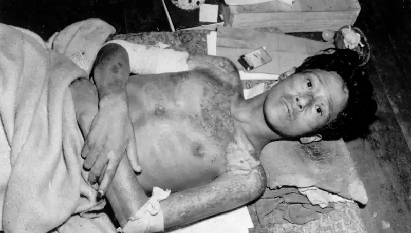 80 Yıl Sonra Nagasaki’den Gelen Alarm: Nükleer Felaket Yeniden Gündemde!