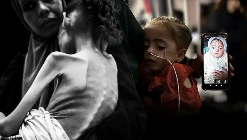 Küçük Meryem'in Dramı: Açlıkla Mücadele Eden 10 Kiloluk Hayat